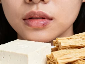 唇炎患者能吃豆制品吗，豆腐腐竹影响大不大？