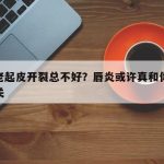 嘴唇老起皮开裂总不好？唇炎或许真和你的体质有关